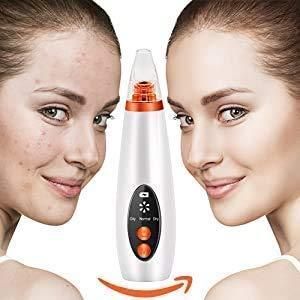 Remove Blackhead Device bqu5q7-dm